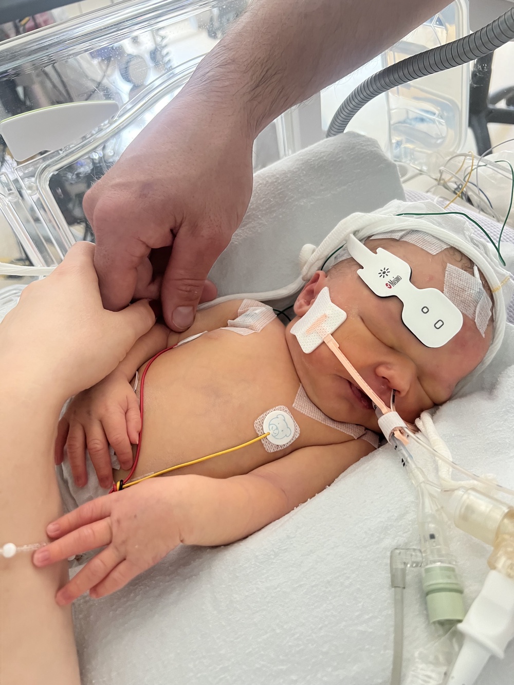 Poppy Hope Lomas who died at University College Hospital, in central London (Family/PA) (Family handout)
