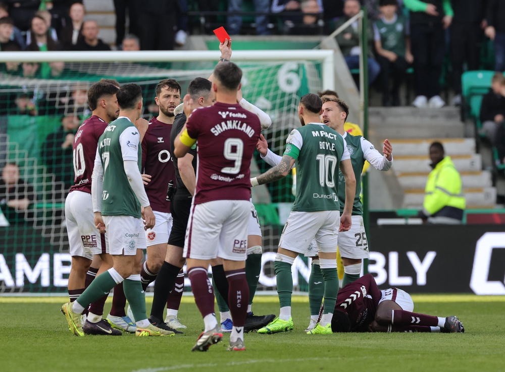 Passlack was then sent off to reduce Hibs down to nine (PA)