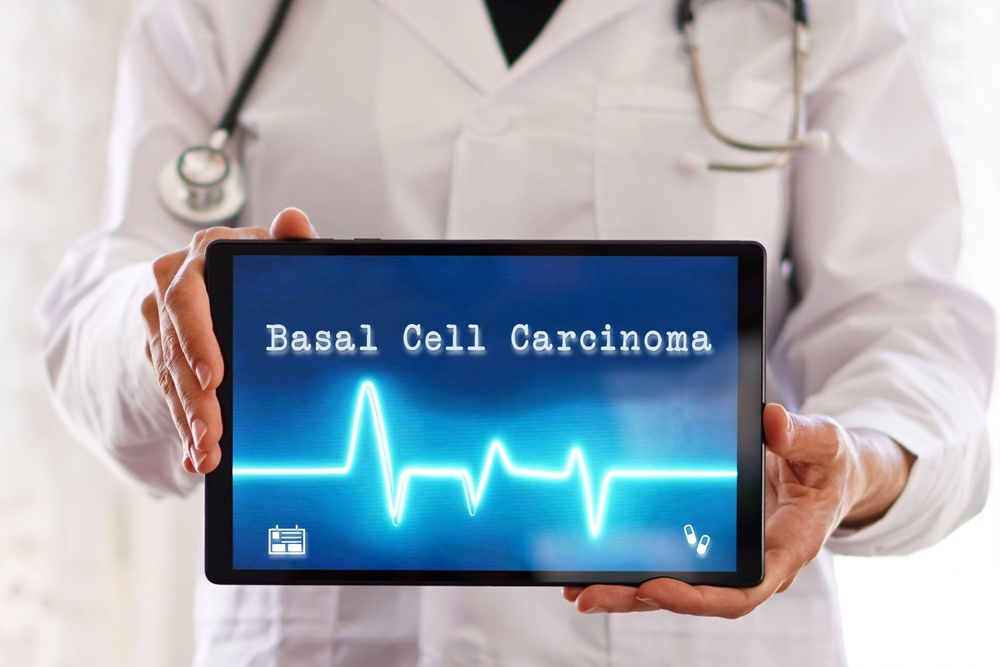 Doctor holding tablet that has Basal cell carcinoma written on it (Alamy/PA)