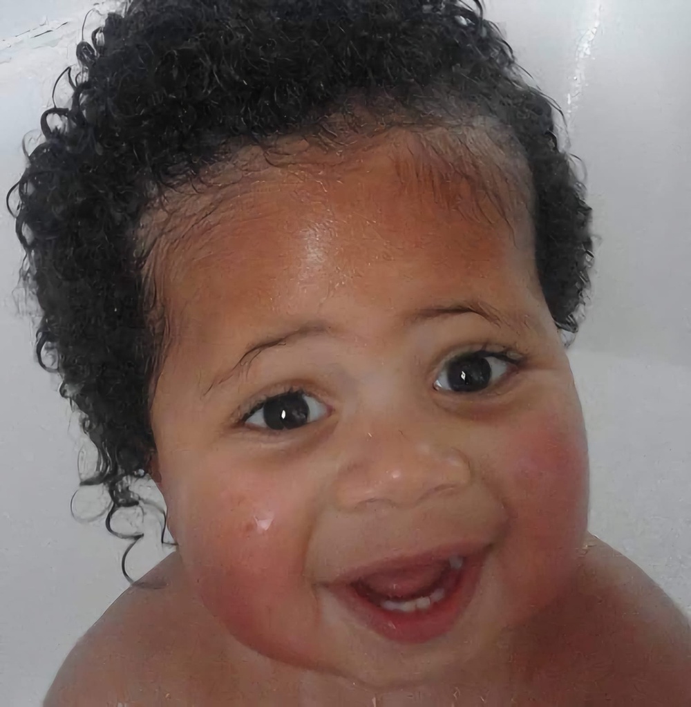 Theo Kempthorne was born with hydrocephalus, a build-up of fluid in the brain (PA)