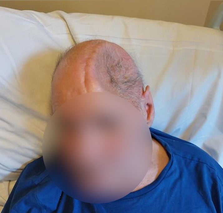 A cyclist who collided with fly-tipped rubbish and sustained a severe head injury when he came off his bike in a lane in Brentwood (Essex Police)