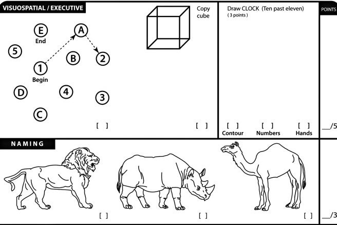 An image showing the kinds of questions that appear on the cognitive tests that President Donald Trump insists he’s “aced.” (MoCA Cognition)
