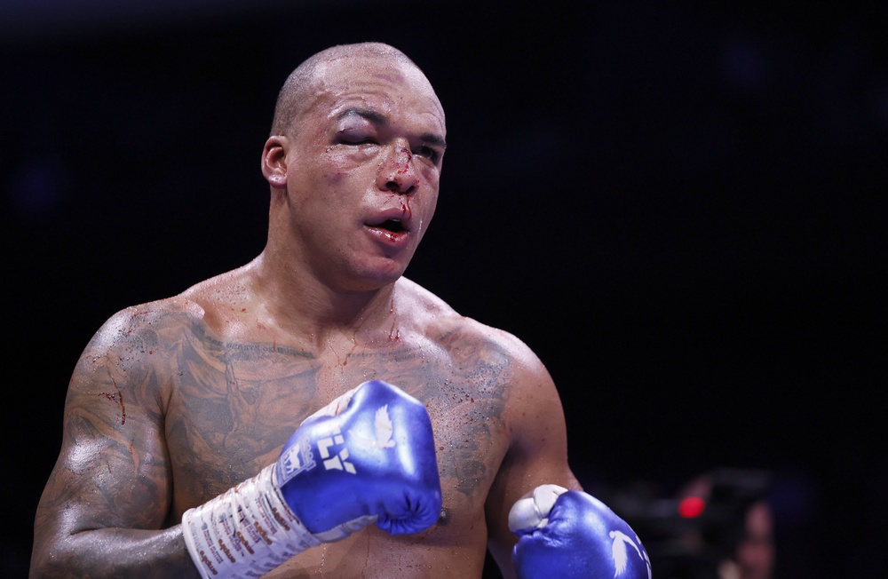 Wardley was left battered and bloodied in Manchester (Richard Sellers/PA) (PA Wire)