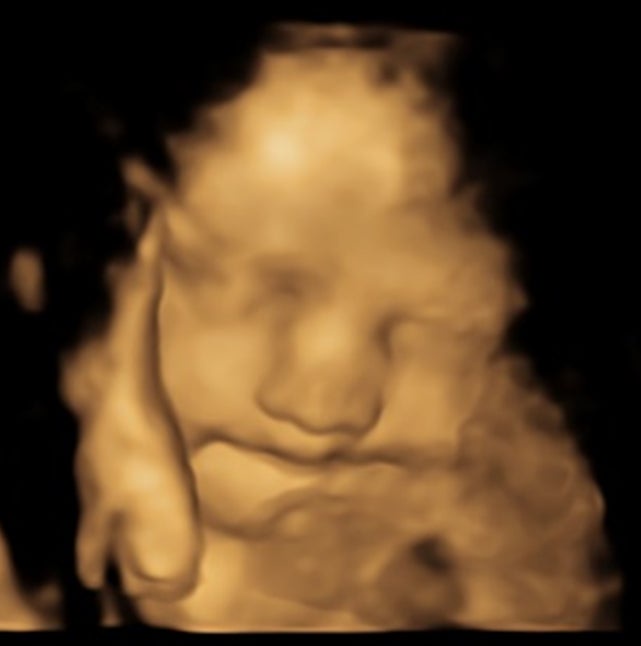 The facial reactions of the foetus whose mother took kale capsules during pregnancy as part of a controlled experiment, scanned using ultrasound at weeks 32 gestation (FETAP Study, Fetal and Neonatal Research Lab, Durham University/PA Wire)