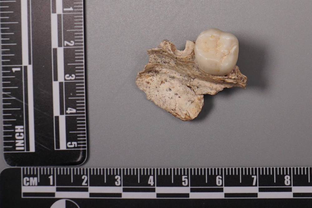 An ancient tooth found at the Sunjiadong archaeological site in China. (Local Library)