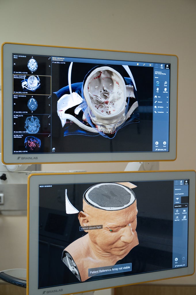 The operation used a keyhole technique (Leeds Teaching Hospitals NHS Trust/PA) (PA Media)