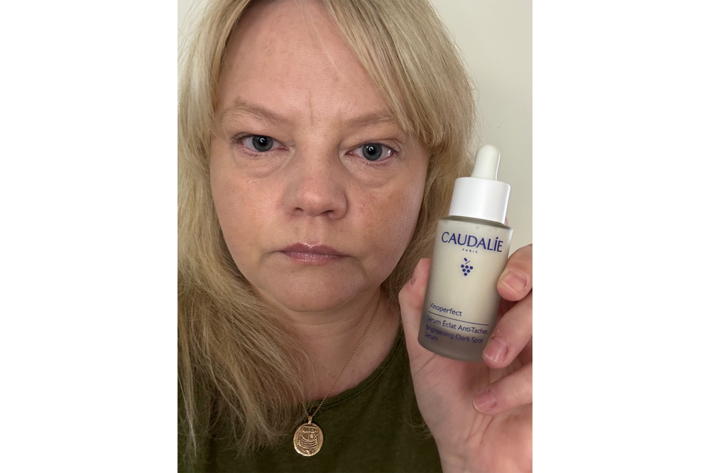Consistent use makes dark spots less noticeable (Sabine Wiesel/The Independent)
