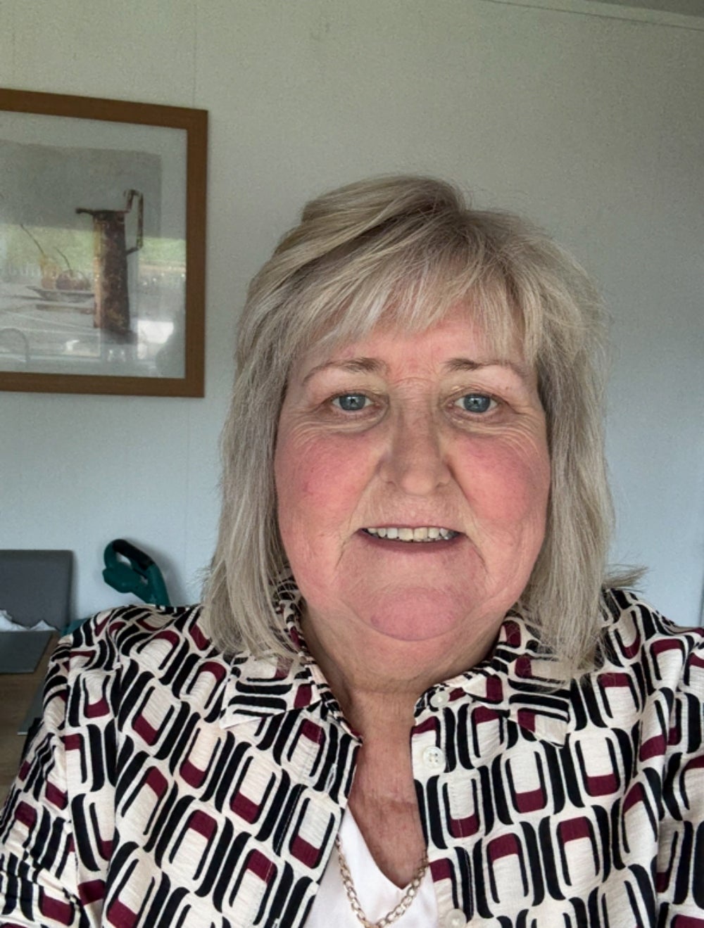 Sandra Watson, 61, from West Lothian, was treated with a new type of cell therapy for advanced liver disease in October 2016 and remains transplant-free. (Credit: Sandra Watson/PA)