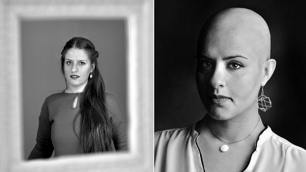 Tahmineh Monzavi spent a month in solitary confinement in 2012 and developed an autoimmune disease that caused her to lose her hair (Tahmineh Monzavi)