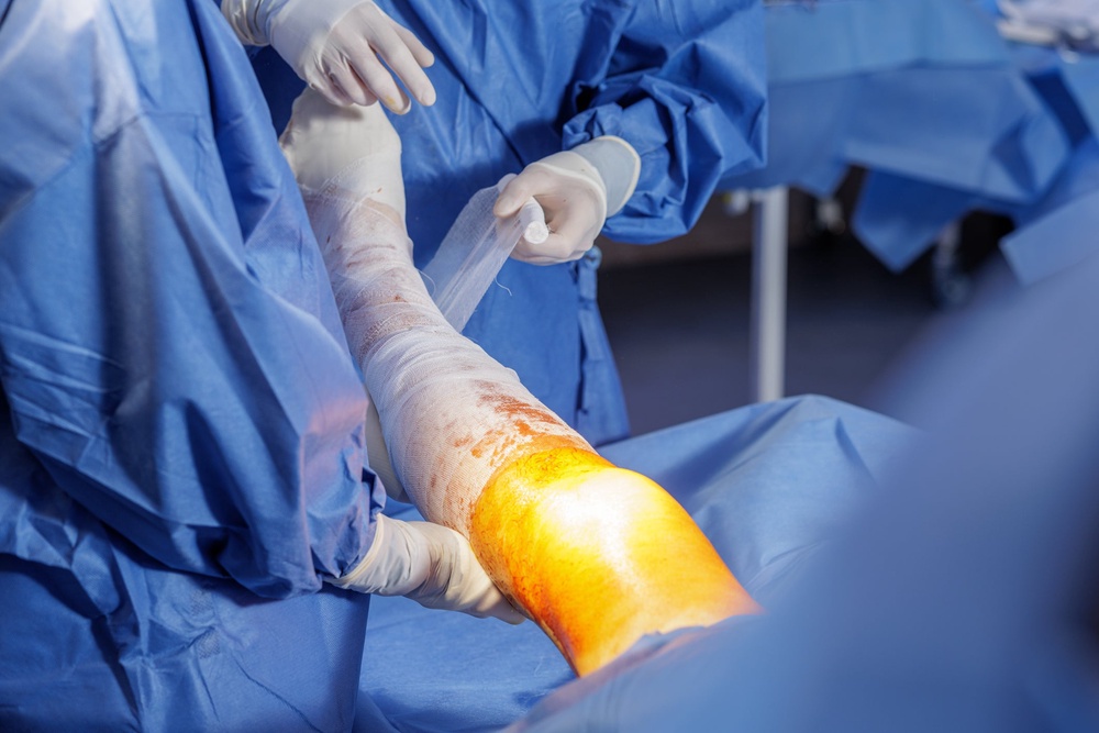 Experts calculated that sorting out complications caused by seven cases of leg-lengthening abroad has cost the NHS just over £36,000. (Getty/iStock)