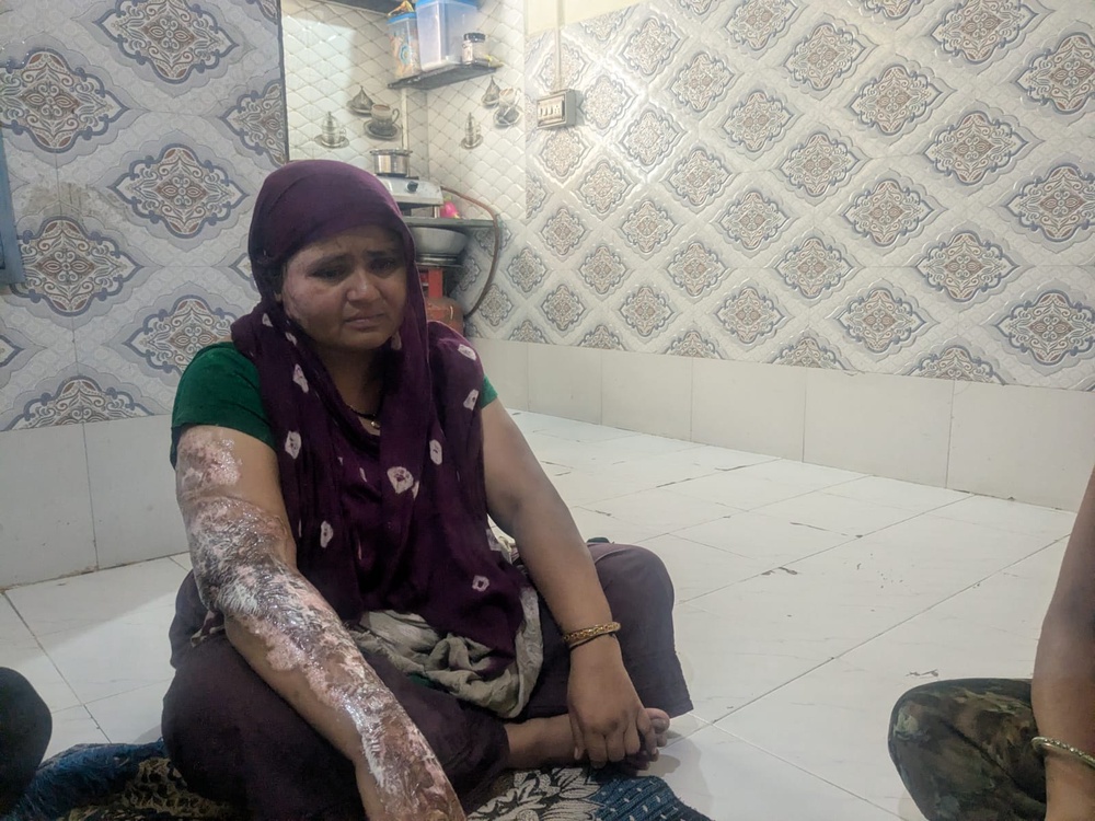 Sitaben Patni suffered severe burn injuries in the crash (Namita Singh/The Independent)