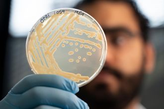 Microbiologist Mohamed Sarhan is examining colonies of yeast taken from a sample of Ötzi’s stomach (Eurac Research/Andrea De Giovanni)