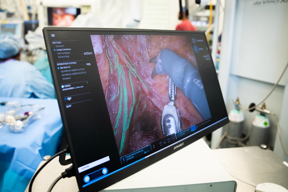 The screen shows nerves and connective tissue (James Manning/PA) (PA Wire)