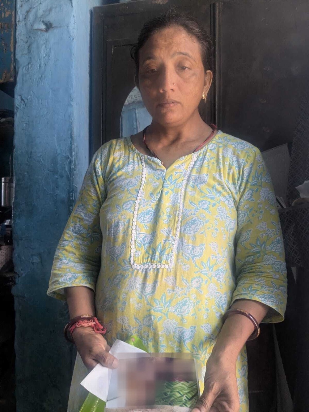 Toralben Lakshari with photographs of her injury from the Air India crash (The Independent)