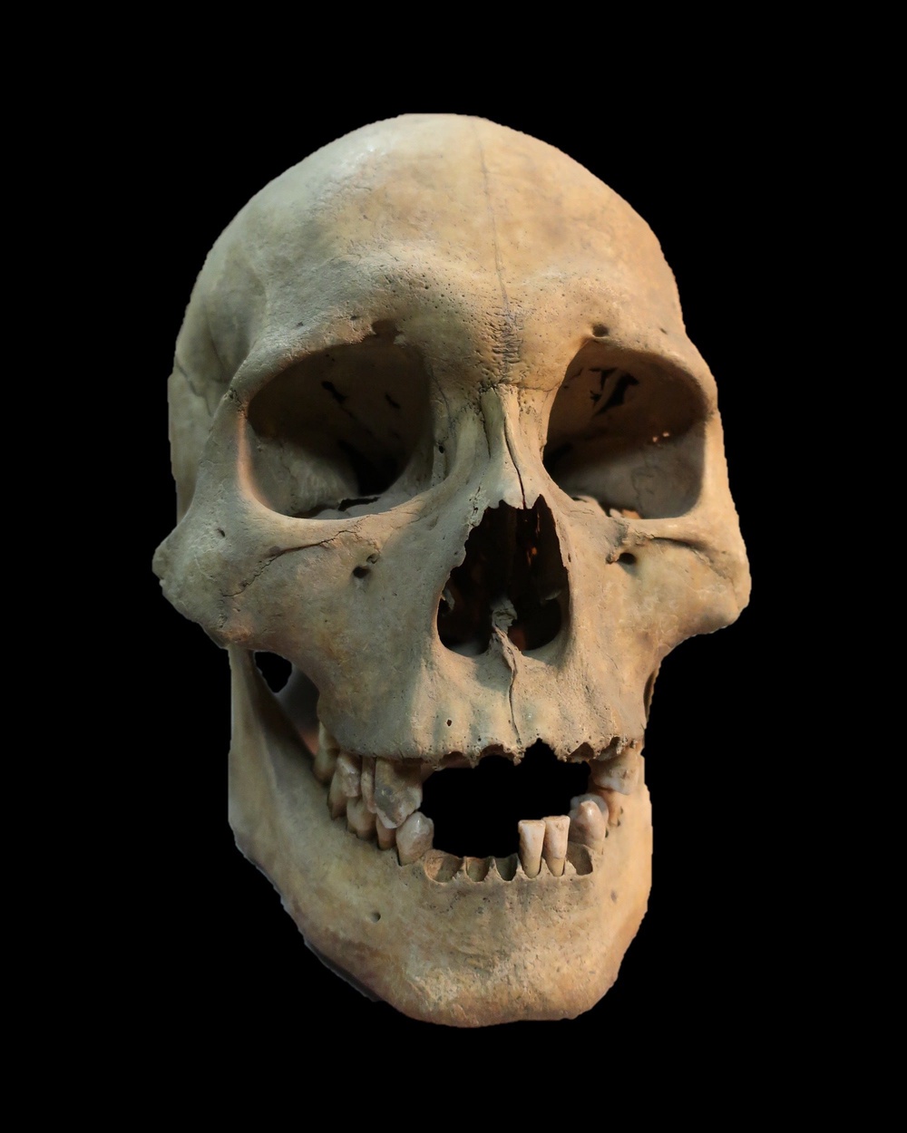 This 2019 image from Angela Lieverse shows the skull of an adult woman who was infected with the plague and was buried in Siberia (Angela Lieverse)