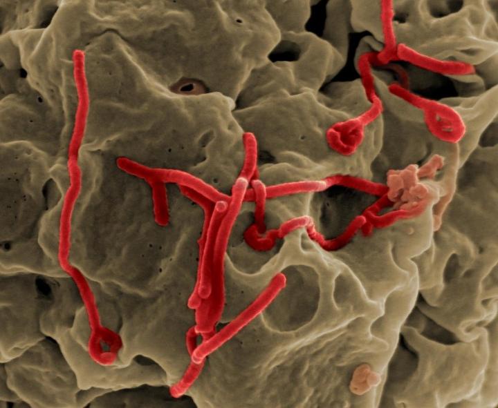 Ebola virus isolated from patient blood samples (NIAID)