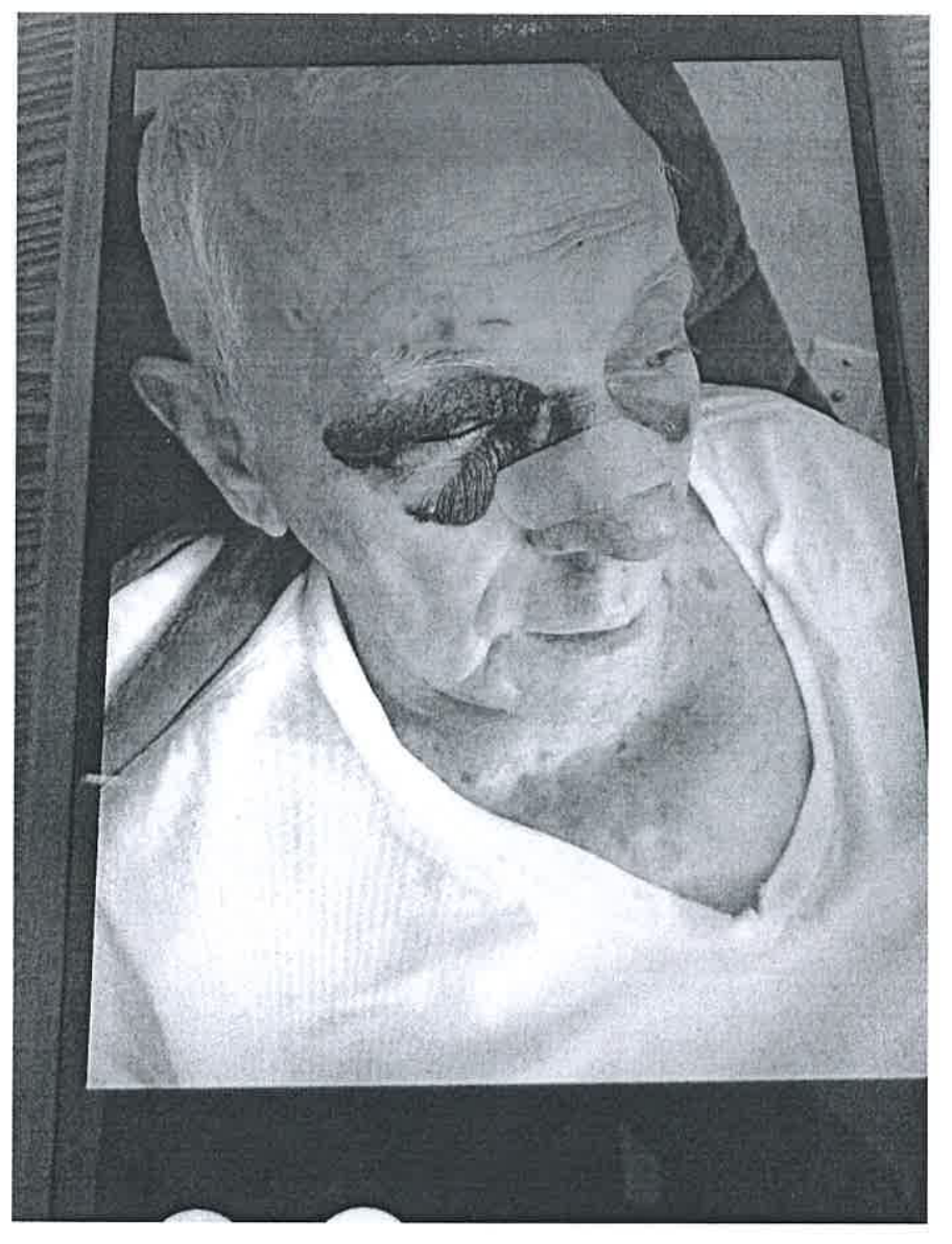 Bowlds, 84, broke his nose and tore his rotator cuff in a fall after getting distracted by a Waffle House ad, according to a lawsuit (U.S. District Court for the Middle District of Florida)