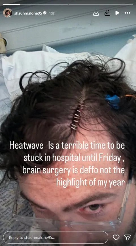 Shaun Malone shares a picture of his surgery stitches on Instagram (Instagram)