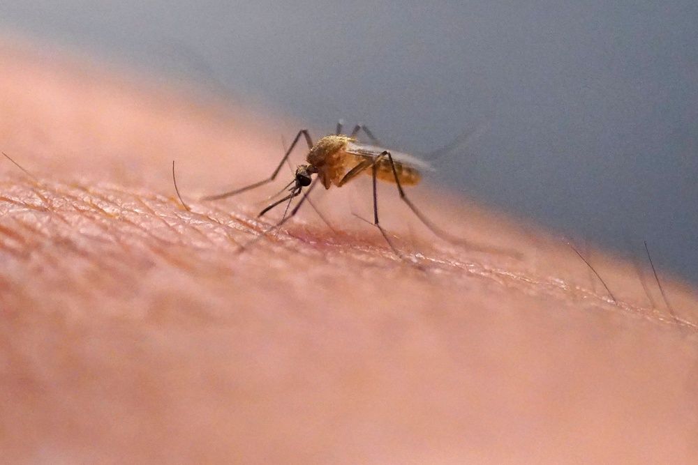 Be Well-Don't Scratch That Itch (Copyright 2023 The Associated Press. All rights reserved)