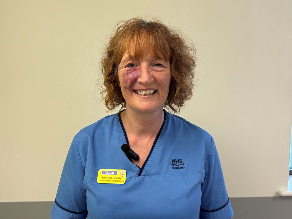 Sharon Ramsay, Burns Nurse at the Royal Hospital for Children, Glasgow (NHS Greater Glasgow and Clyde/PA Wire)