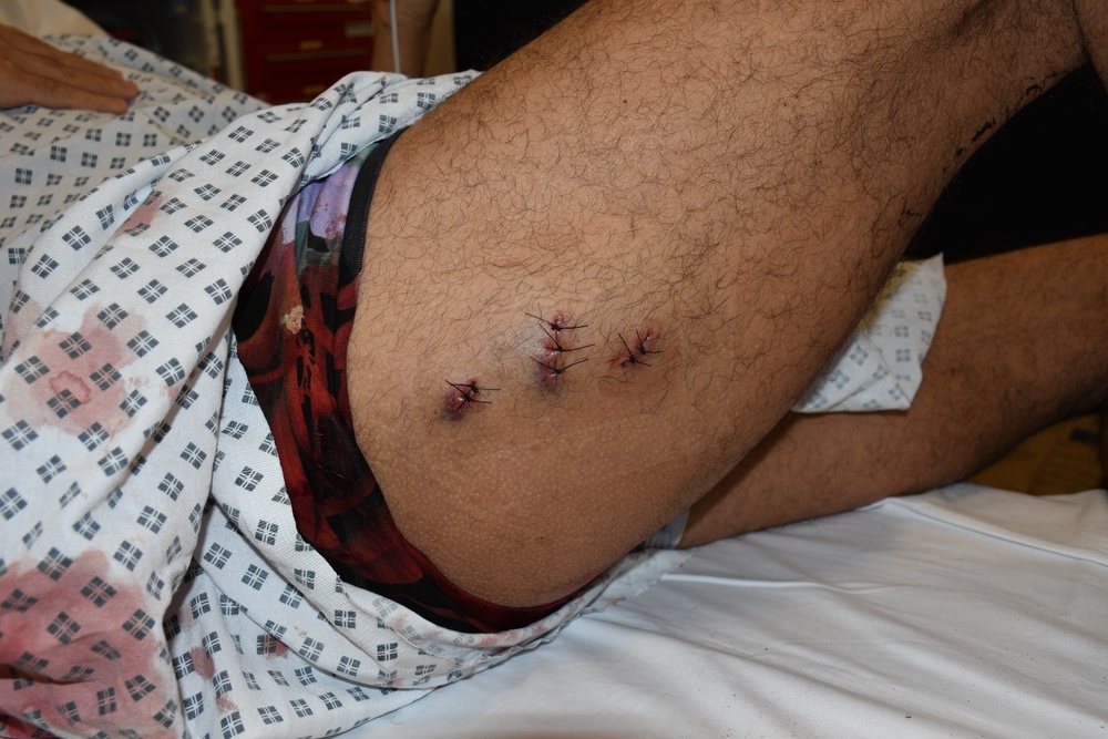 Pouria Zeraati was left bleeding in the street after the attack (PA)