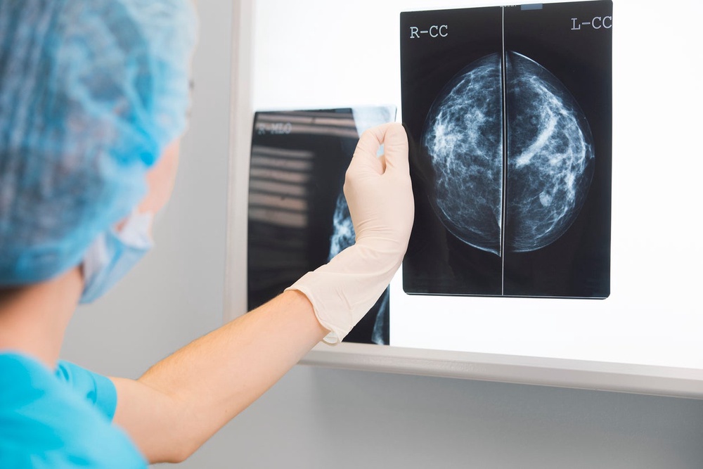 University of Cambridge researchers analysed data from 1,258 women under 50 in the Breast Cancer Now Generations Study (2004-2011) (Getty/iStock)