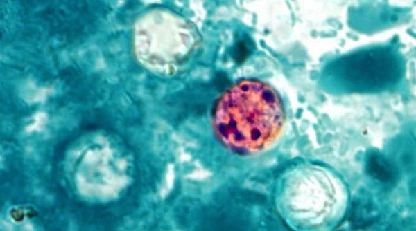 Exposure to the cyclospora parasite leads to cyclosporiasis, a stomach bug that can cause explosive diarrhea (CDC)