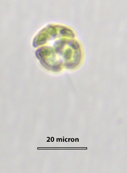 Microalgae under microscope (Shauna Murray)