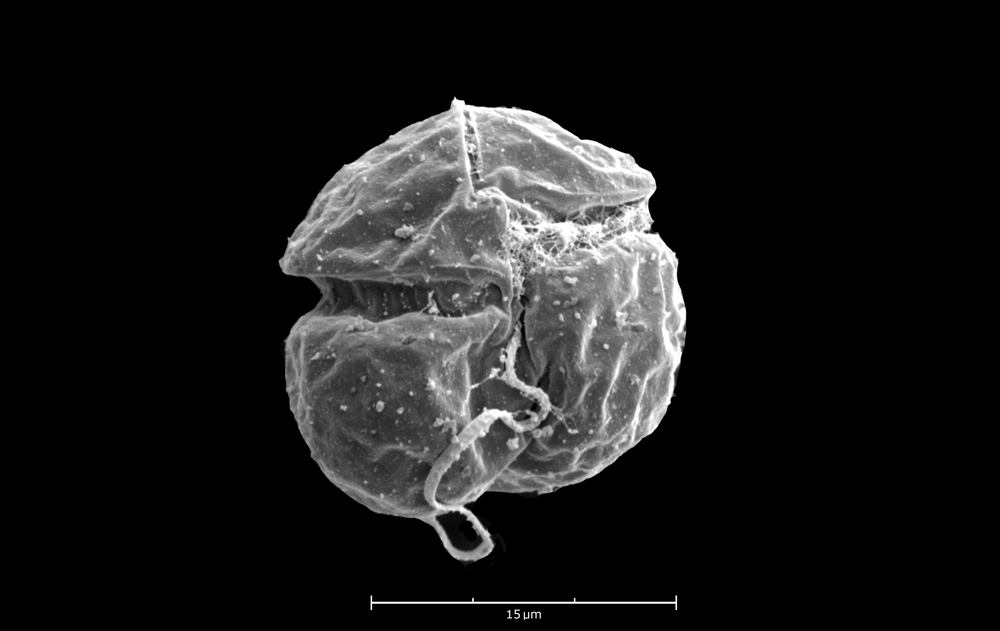 K cristata microalgae species (Shauna Murray)