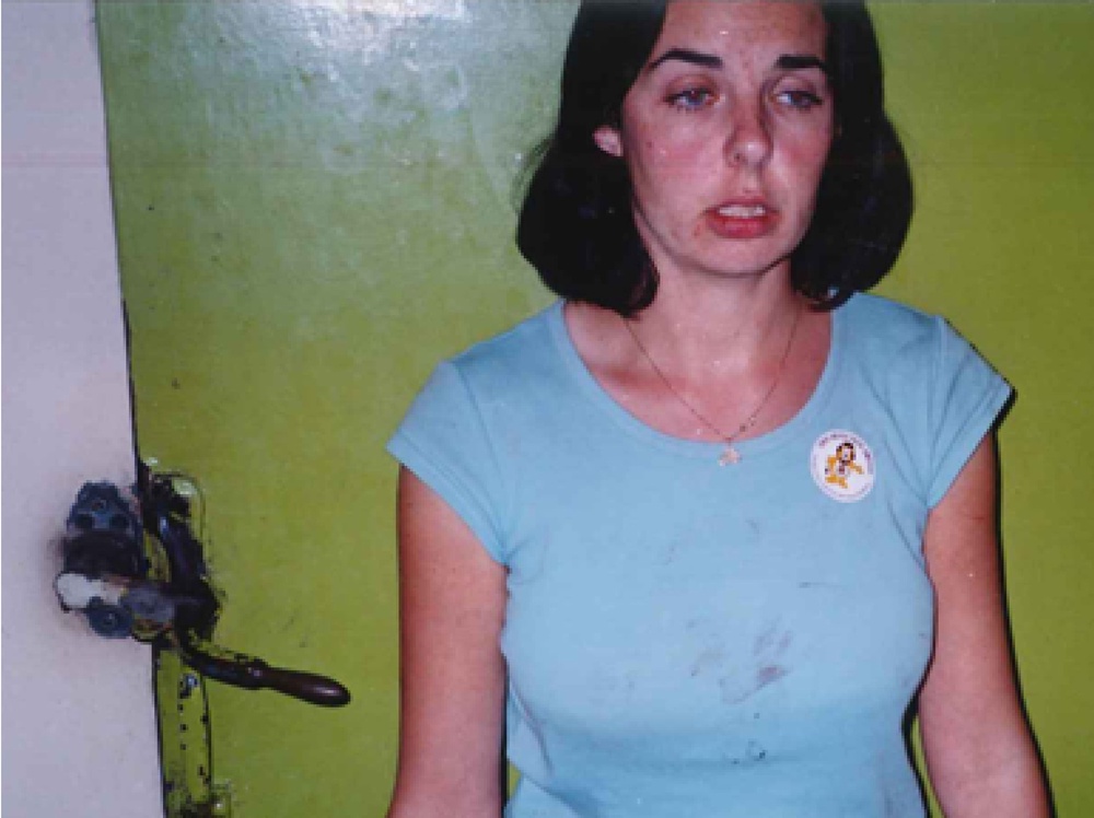 Police photograph of Joanne Lees taken hours after the attack (Northern Territory Police/PA Media)