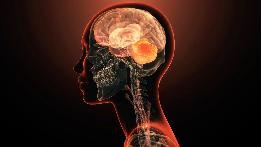 New findings suggest Biogen's diranersen not only reduced tau levels but also indicated a slowdown in cognitive decline (Getty Images)
