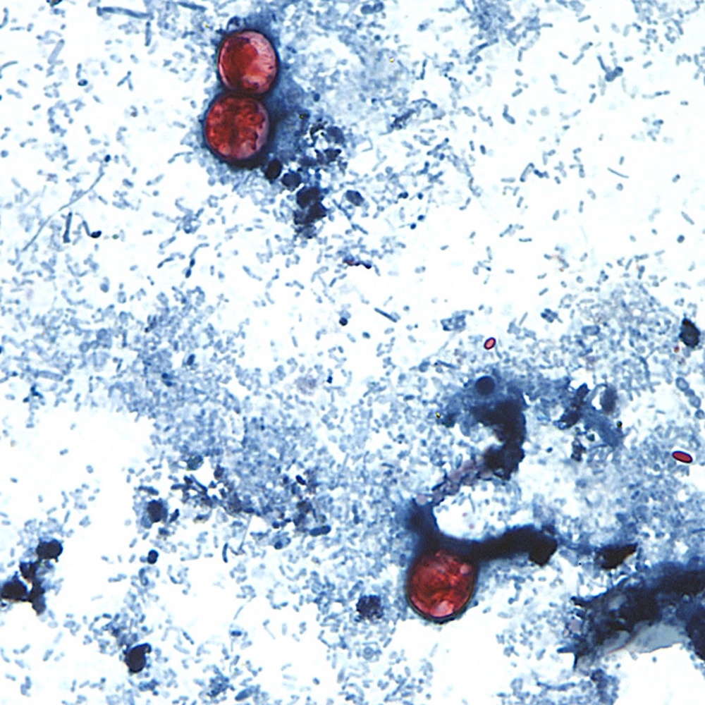 People become infected with cyclosporiasis, an intestinal illness, by consuming food or water containing the microscopic parasite cyclospora, pictured here. (AP)