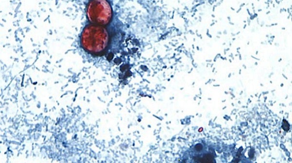 The CDC is tracking nearly 7,000 cases of cyclosporiasis — roughly 27 time the level at this point last year — as the gastrointestinal illness spreads across the United States. (CDC)