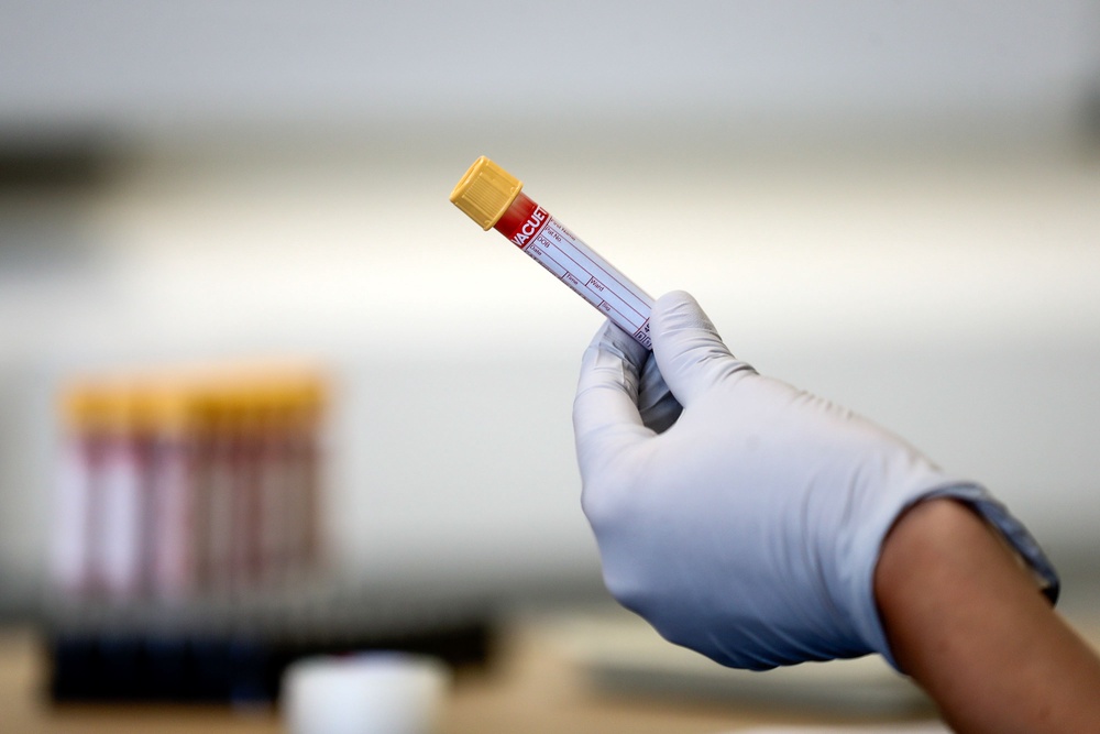 A common autoimmune disorder could be detected by a blood test more than a decade before symptoms show, scientists have found (PA Archive)