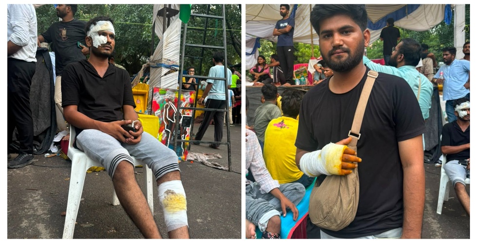 (L) Aniket Patil and Mayank were beaten by the police with batons at the New Delhi protest on 20 July 2026. (Alisha Rahaman Sarkar/ The Independent)