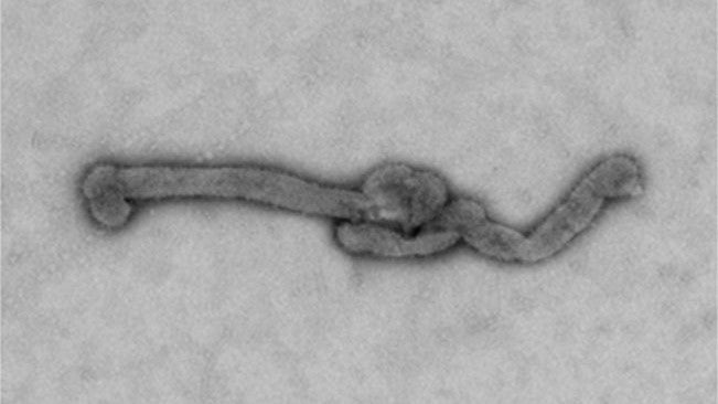 Bourbon virus is a RNA virus that was discovered in Bourbon County, Kansas, in 2014 (CDC)