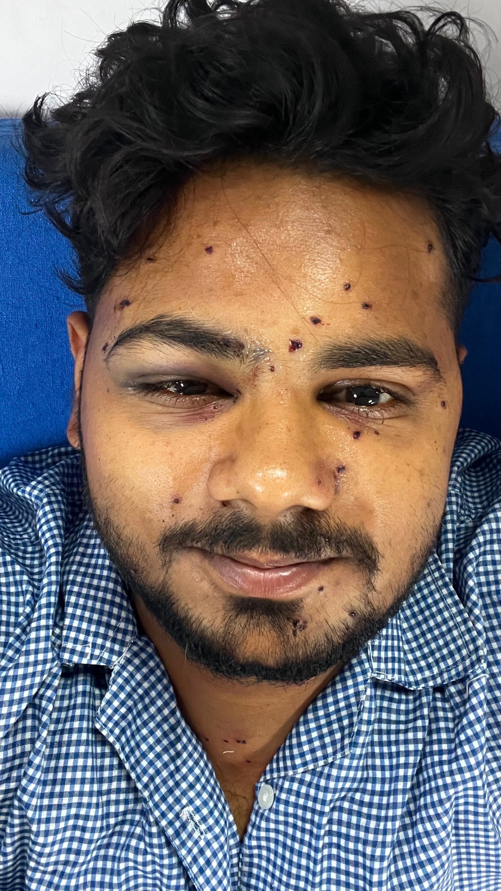 Mansoori in hospital ahead of his surgery (Supplied)
