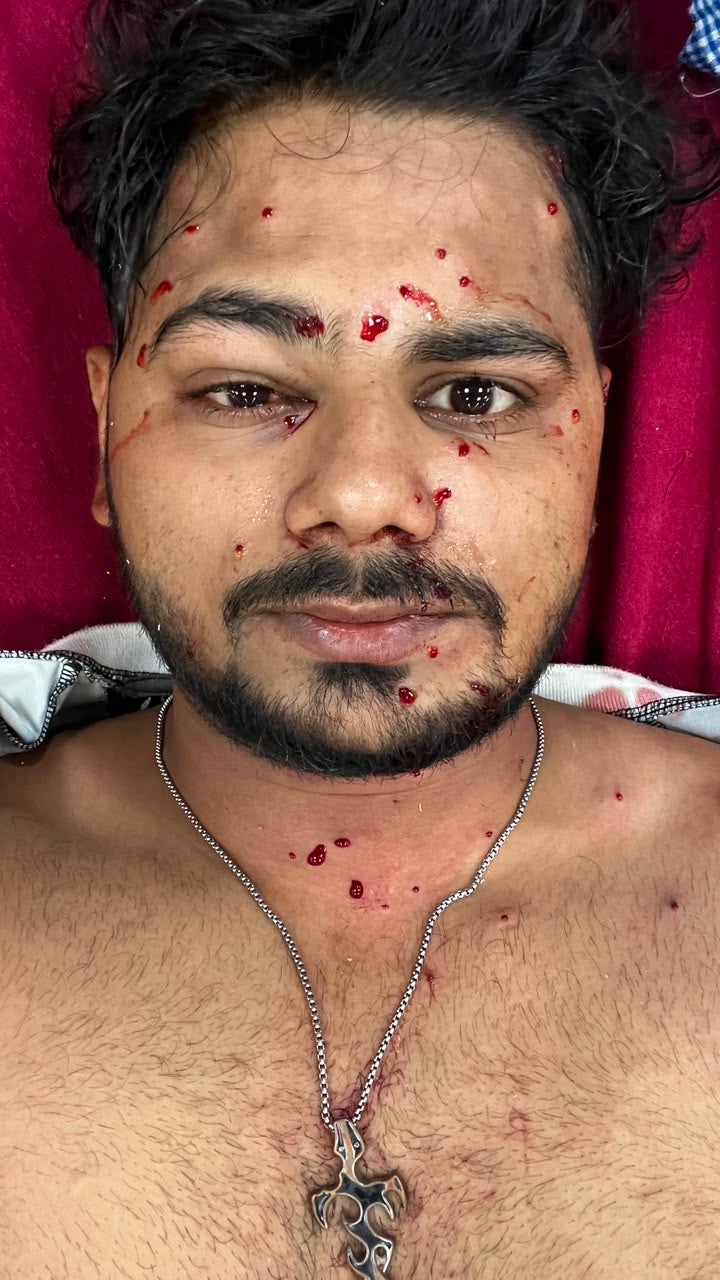 Shaikh Irshad Mansoori in a Delhi hospital (Supplied)
