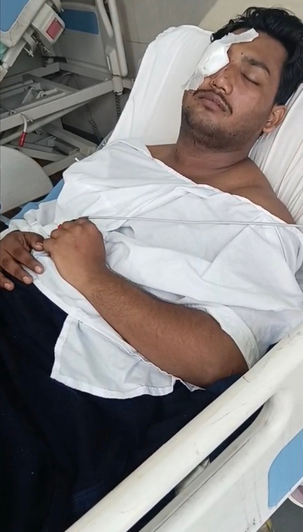 Lohchab after surgery to remove pellets from his face and chest (Supplied)