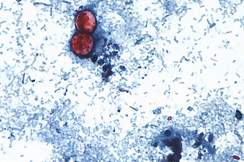 Cyclospora cayetanensis, a microscopic parasite, is the culprit behind cyclosporiasis (CDC)