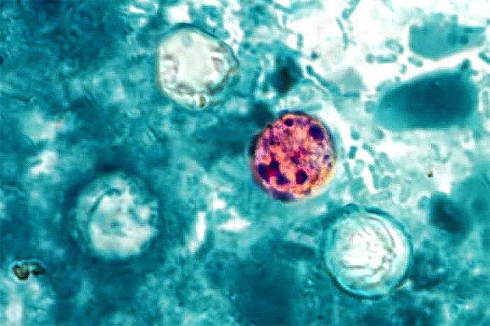 Federal health officials have linked the parasite outbreak to more than 22,000 illnesses and 500 hospitalizations nationwide, with Michigan hit hardest (Wiki Commons)