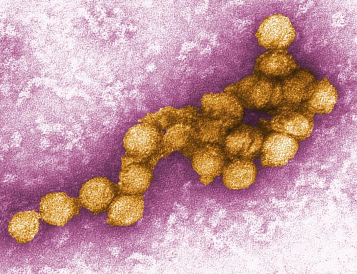 The West Nile virus is seen under a microscope. Severe infections can lead to paralysis, coma, vision loss and spine and brain inflammation (CDC)
