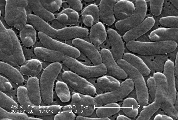 A grouping of Vibrio vulnificus bacteria is seen in this scanning electron microscopic image. The bacteria thrives in warmer waters (NOAA CoastWatch via CDC)