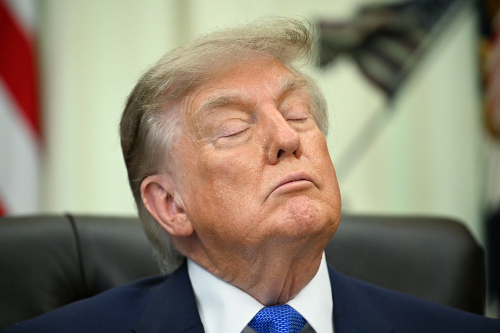 Trump has faced growing scrutiny over his hand bruising, leg swelling and moments where he appears to nod off on camera (AFP via Getty Images)