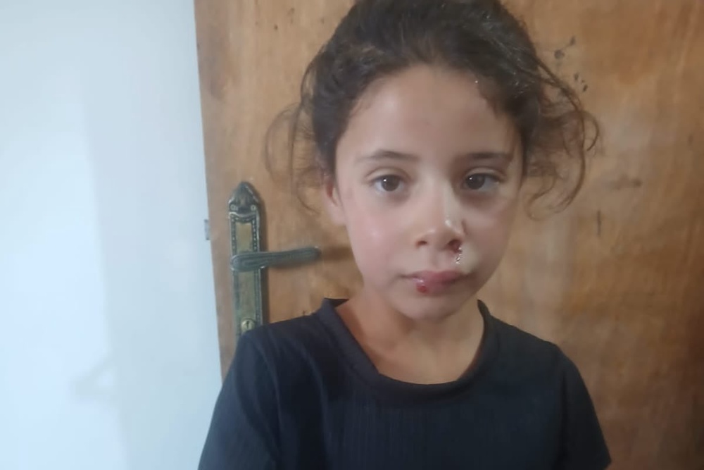 Razan, eight, was left with injuries to her face after being struck by a stone during the attack (Radwan Jundiya)