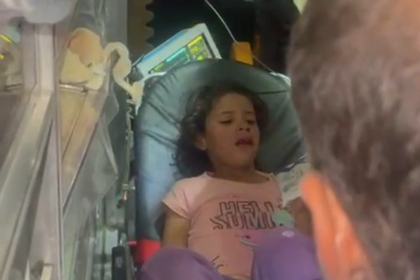 Razan, just eight years old, was left with a nasal fracture (Mohammad Hesham)