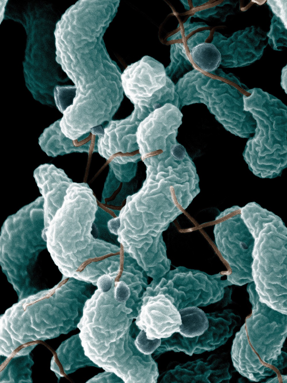 Campylobacter can be extremely risky to people over 65, according to the Centers for Disease Control and Prevention. Roxie Ellis Douglas, 68, is suing Wendy's over claims she contracted campylobacteriosis from a double cheeseburger she ordered from the chain (Creative Commons)