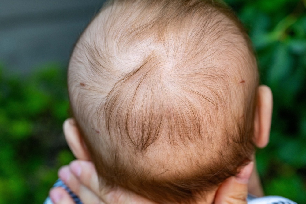 Ms Clarkson screamed before realising the full horror as she saw four, bloody puncture wounds on her baby's head (SWNS)