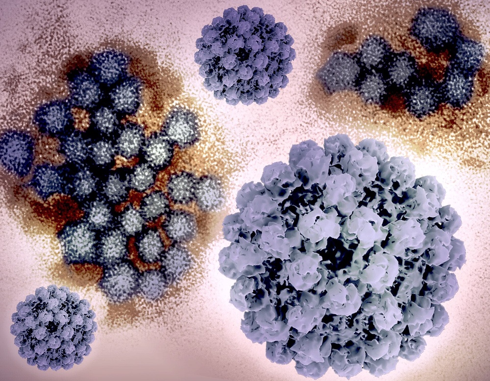 A newlywed couple's wedding reception was ground zero for more than 30 norovirus infections, according to court filings (Creative Commons)