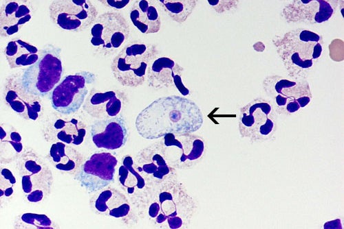Naegleria fowleri (pictured) can cause a deadly infection known as primary amebic meningoencephalitis (CDC)